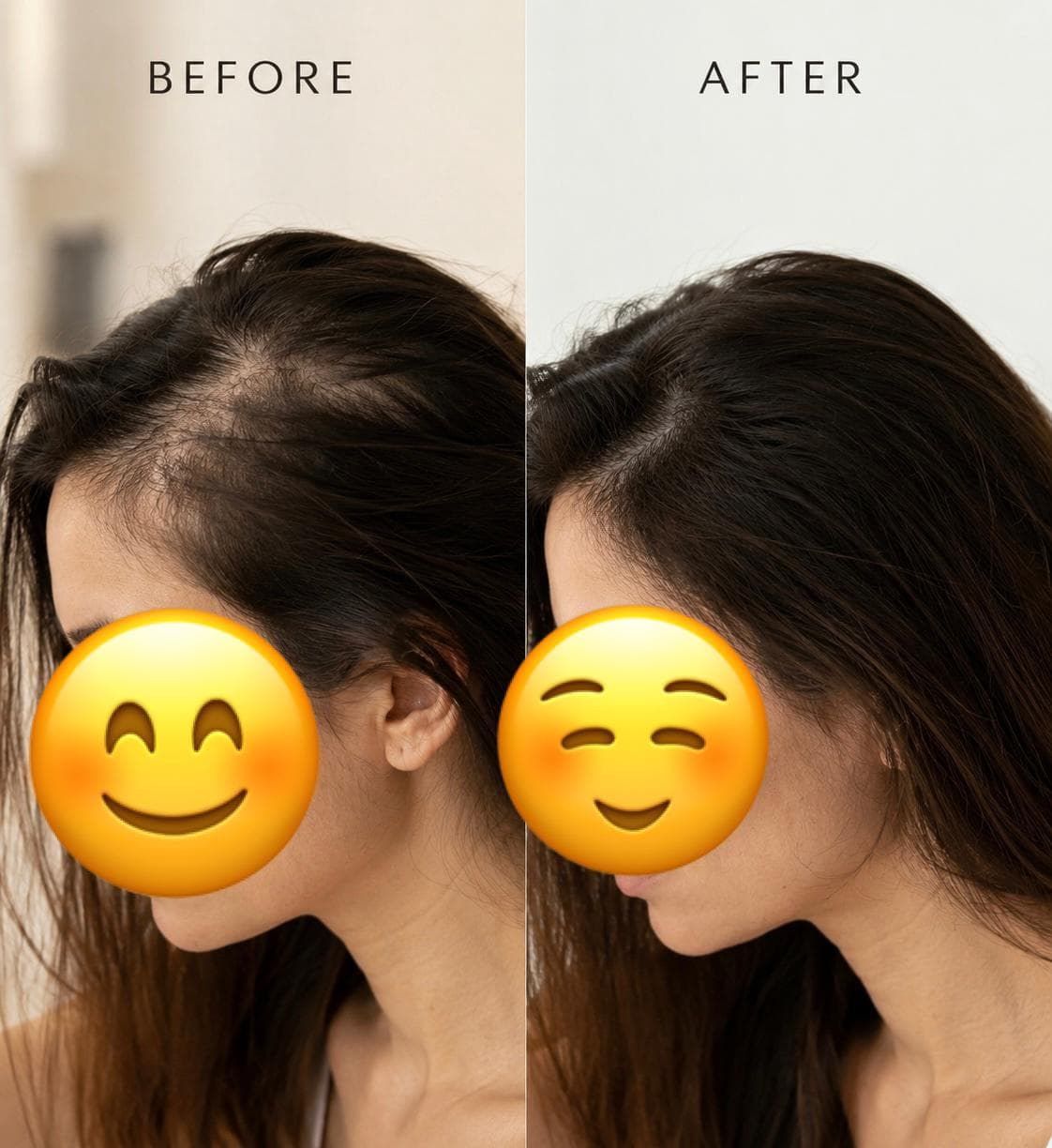 Before and after transformation — سناء