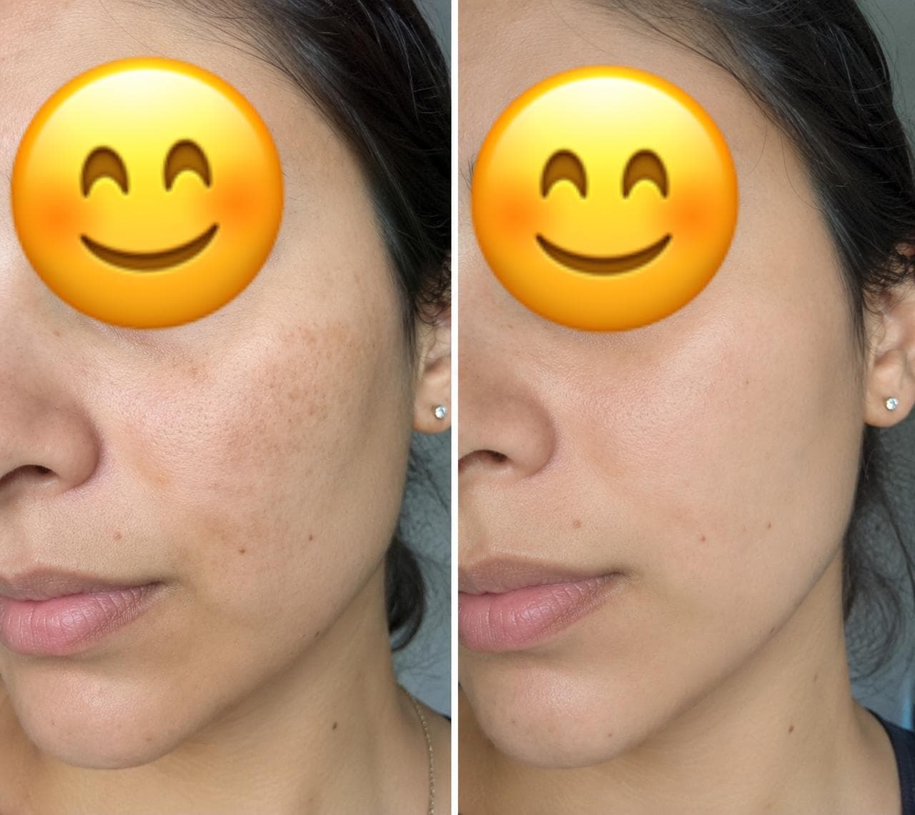 Before and after transformation — Khadija