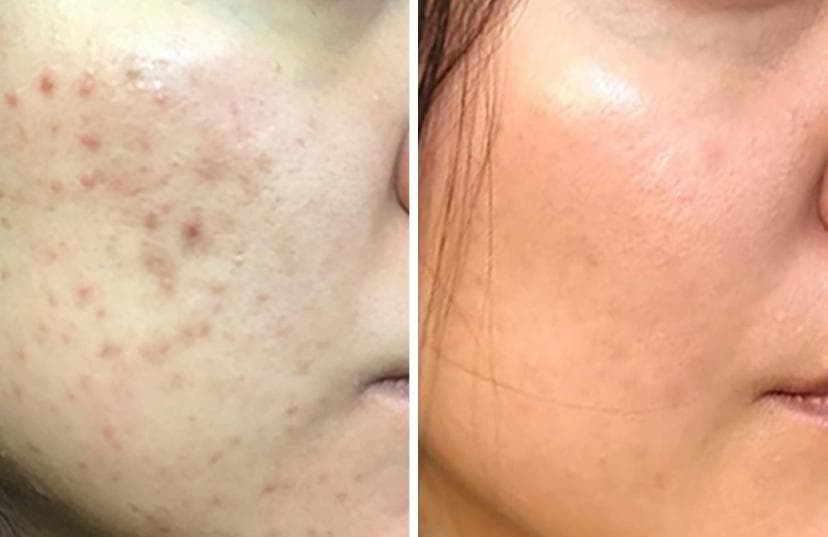 Before and after transformation — Saadia